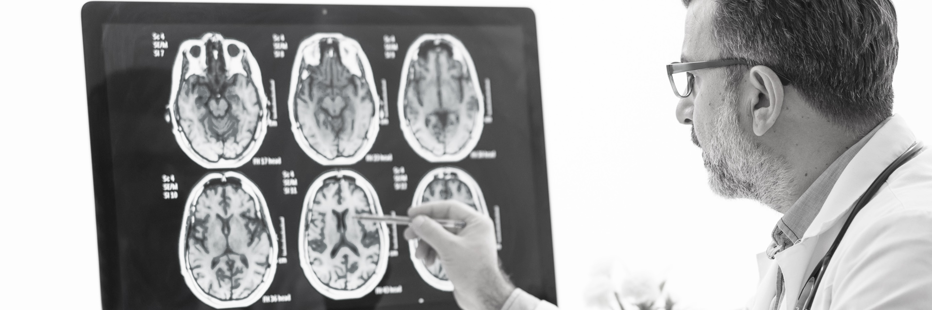 Neurologist examining brain scans